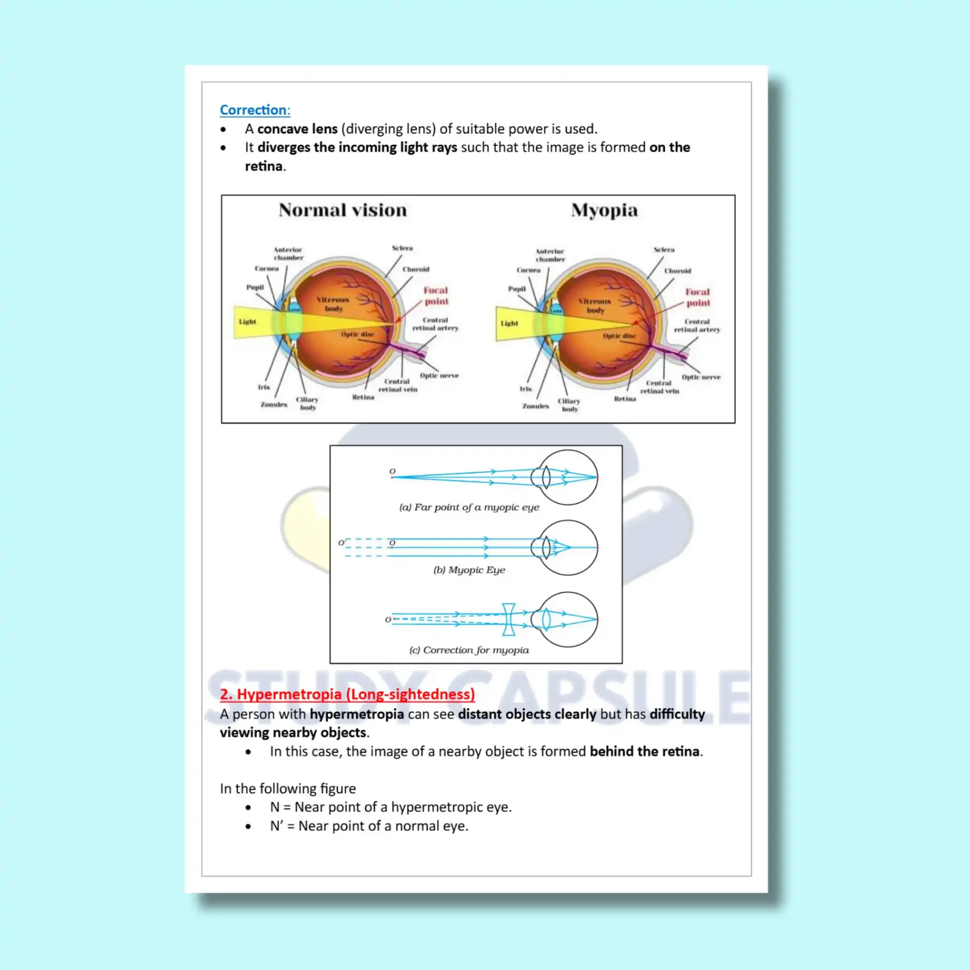 Class 10 Science | Ch 10- Human Eye notes